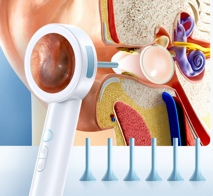 HD Visual Ear Camera – 1.8-Inch Screen Otoscope with Instant View and Recording for Kids, Adults, Dogs and Cats, Gentle Ear Cleaning Tool