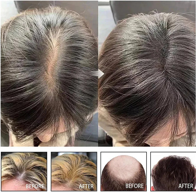 Hair Growth Serum– Anti Hair Loss Essence Treatment for Stronger Fuller Hair Growth in Men and Women