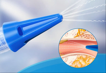 Ear Wax Removal Kit – Manual Ear Irrigation Cleaning System for Safe Effective Ear Care for Adults and Children