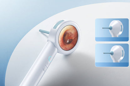 HD Visual Ear Camera – 1.8-Inch Screen Otoscope with Instant View and Recording for Kids, Adults, Dogs and Cats, Gentle Ear Cleaning Tool