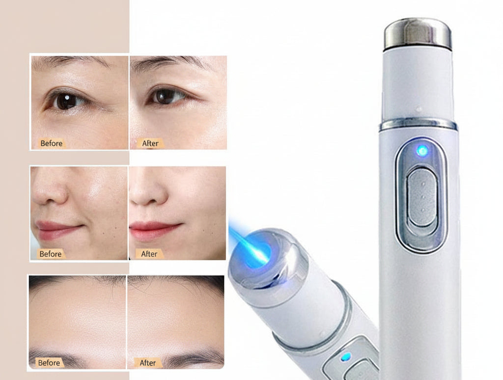 Blue Light Therapy Care Pen – Gentle Skin Treatment Device to Reduce White Spots with Safe Comfortable Daily Use
