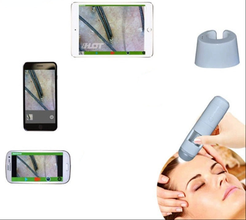 Digital Scalp Analyzer – 50X/200X Hair Follicle Dermatoscope Camera for Skin and Hair Health Inspection