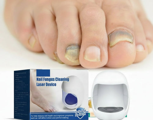 Laser Nail Fungus Treatment Device – Rechargeable Infrared Blue Light Therapy Tool for Toenail Care and Healthy Nail Recovery