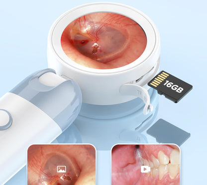 HD Visual Ear Camera – 1.8-Inch Screen Otoscope with Instant View and Recording for Kids, Adults, Dogs and Cats, Gentle Ear Cleaning Tool